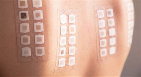 Google is still testing ARM’s patch