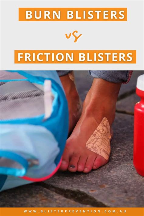 Groin Friction Burn Blister In Dogs: Causes, Symptoms, And Treatment