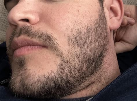 Growing A Full Beard Reddit
