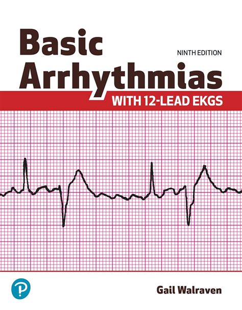 Guide to Basic Arrhythmias