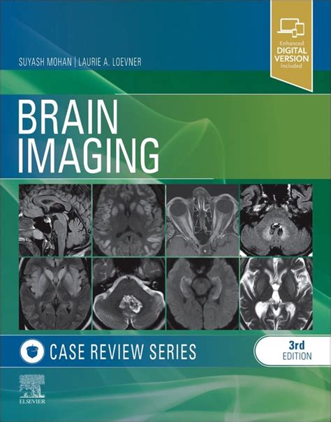 Guide to Brain Imaging: Case Review Series
