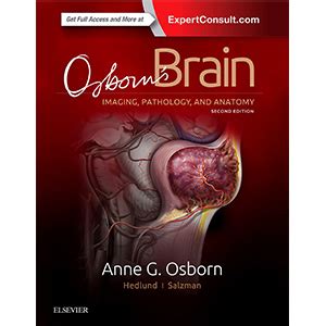 Guide to Essentials Of Osborn's Brain E-Book