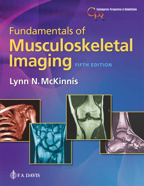 Guide to Fundamentals Of Musculoskeletal Imaging