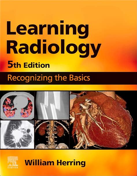Guide to Learning Radiology E-Book