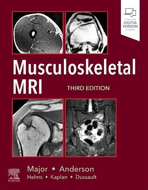Guide to Musculoskeletal MRI E-Book