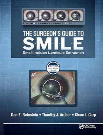 Guide to The Surgeon's Guide To SMILE: Small Incision Lenticule Extraction