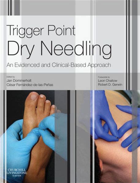 Guide to Trigger Point Dry Needling E-Book