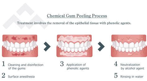 10 Effective Ways to Deal with Gums Skin Peeling Off