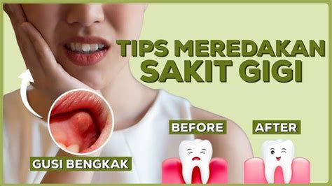 Gusi Bengkak