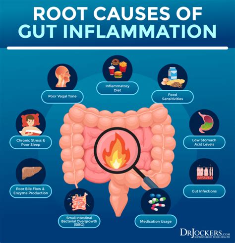 Gut Inflammation: Causes & Relief Strategies