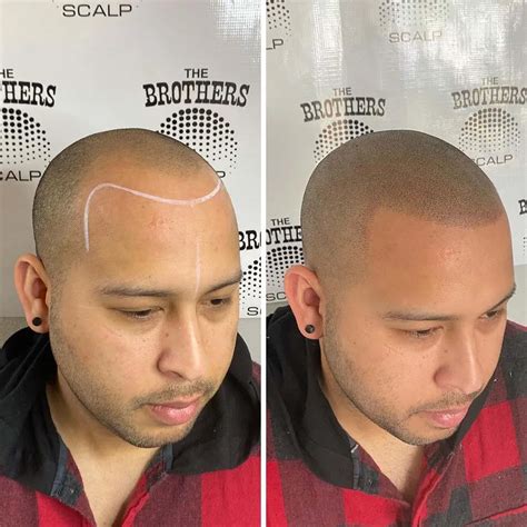 Hair Line Tattoo