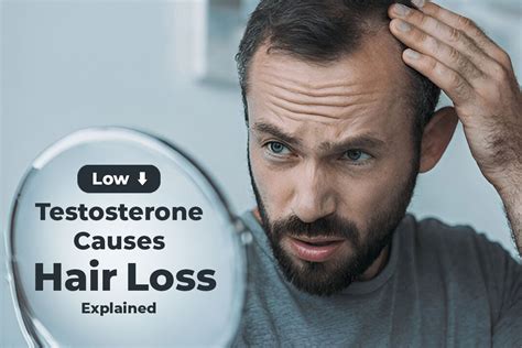 Hair Loss and Testosterone Concerns