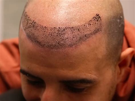 38 Popular Hairline Tattoo Ideas to Get Inked In Style