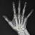 Hand Bones Anatomy Xray