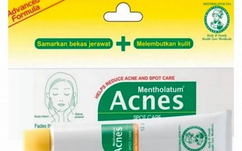 Harga Obat Jerawat Acnes Terbaik Di Indonesia