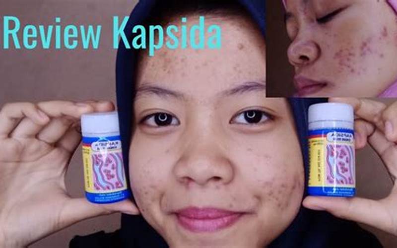 Harga Obat Kapsida Untuk Jerawat Terbaik Di Indonesia