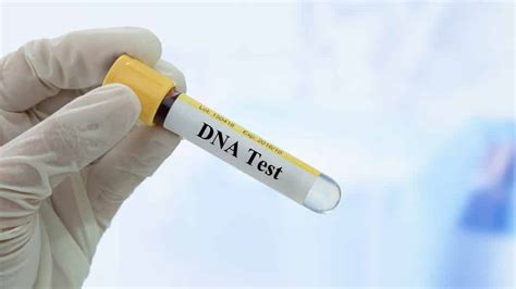 Harga Tes DNA RSCM, Ini Semua yang Perlu Anda Ketahui!