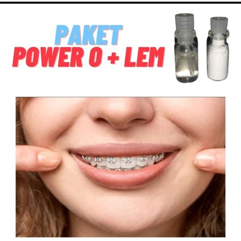 Harga Behel Permanen Asli