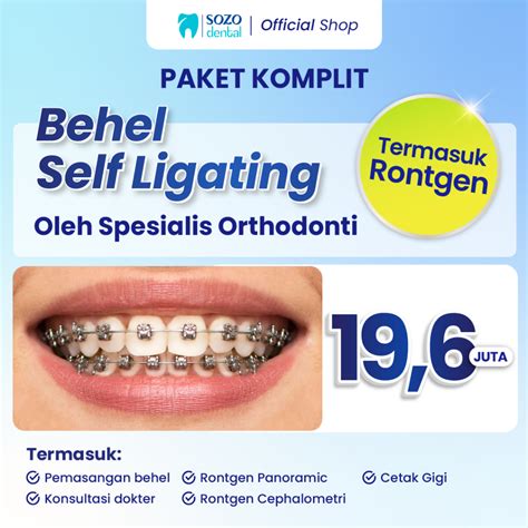 Harga Behel Self Ligating