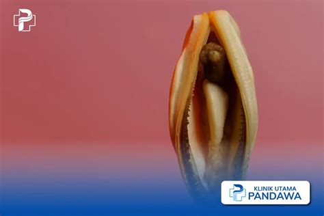 Harga Operasi Miss V