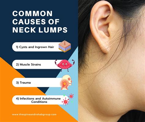 Harmless Neck Lumps: 5 Key Characteristics