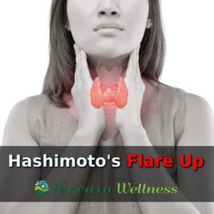 Unmasking the Mystery: The Connection Between Hashimoto's Disease and Skin Flare-Ups