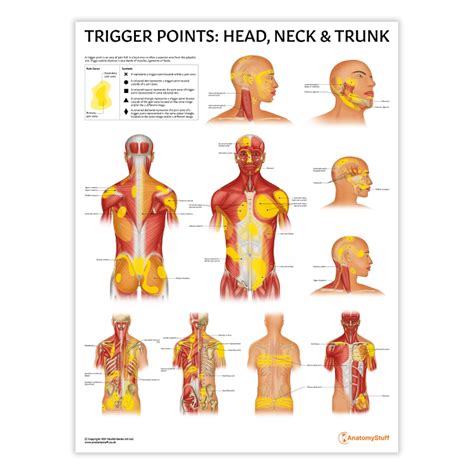 Head Trigger Points Chart