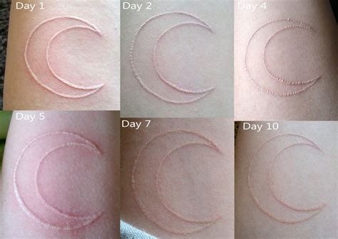 Healing White Tattoo