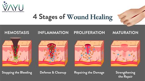 Healing the Wounds