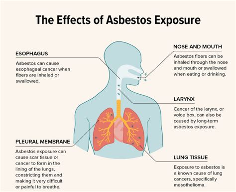 Health Risks of Asbestos Exposure