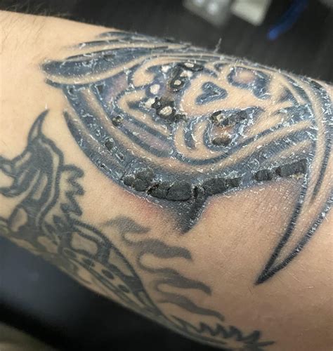Healthy Tattoo Scabbing