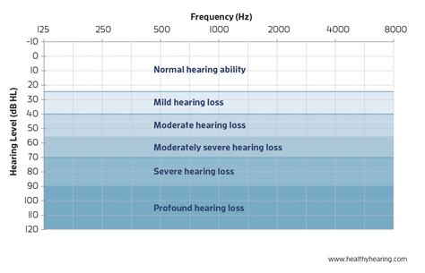 Hearing Loss Levels Chart
