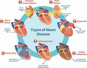 Heart Disease Image