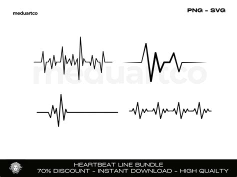 Download Heartbeat Files