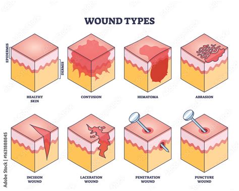 High-Risk Wounds Defined