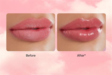Hindari Penggunaan Produk Perawatan Bibir Berbahan Iritan