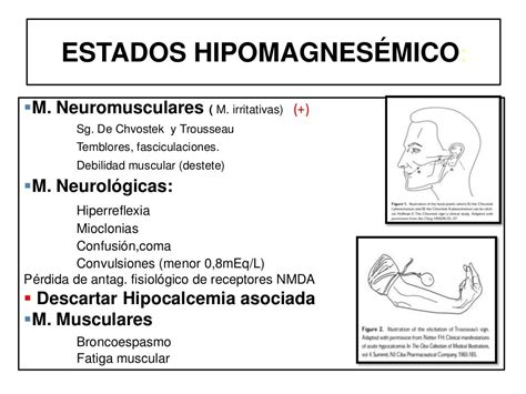PPT Hipomagnesemia de Origem Hereditária revisão da literatura