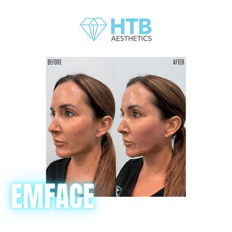 Discover the Allure of Holden's Timeless Beauty: Experience Unmatched Elegance and Sophistication