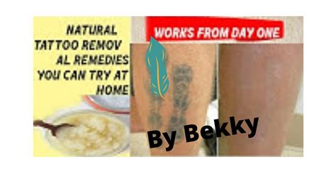Homemade Tattoo Removal YouTube