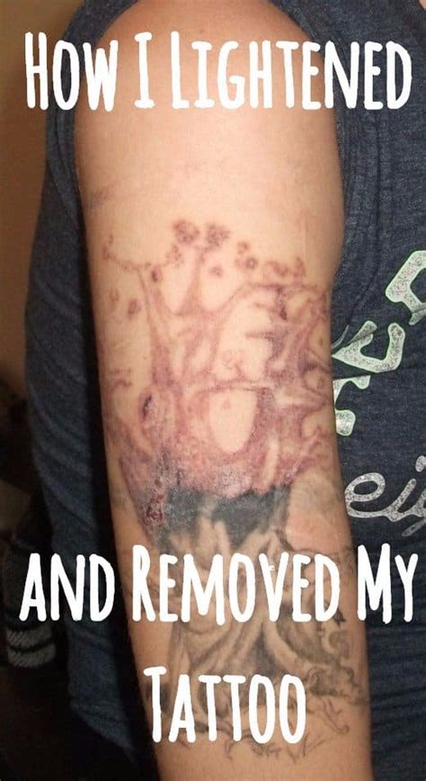 How To Remove Tattoos At Home Avoiding The Expensive