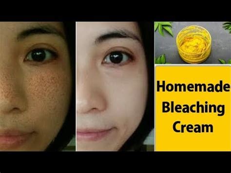 Homemade Skin Bleaching Cream