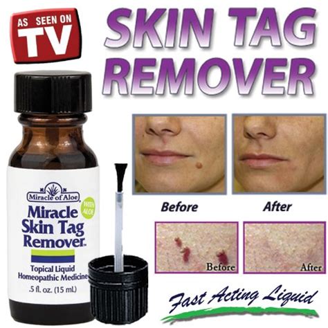 Revitalize Your Skin with the Power of Nature: Discover the Magic of Homeopathic Skin Tag Removal