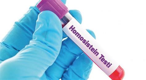 Homosistein