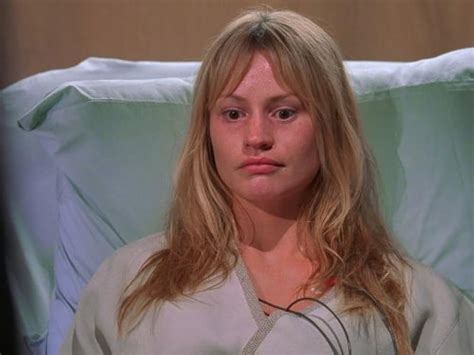 Uncovering the Hidden Truths of House MD's Skin Deep Episode