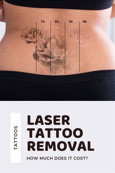 How Much Does It Cost For Laser Tattoo Removal