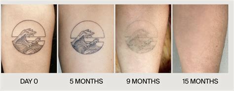 Here’s What You Need To Know About Tattoo Fading Tattoo