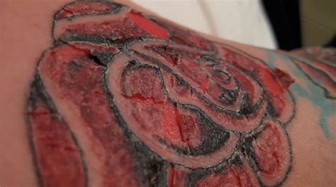 What to Do If Your Tattoo Gets Infected How to Treat