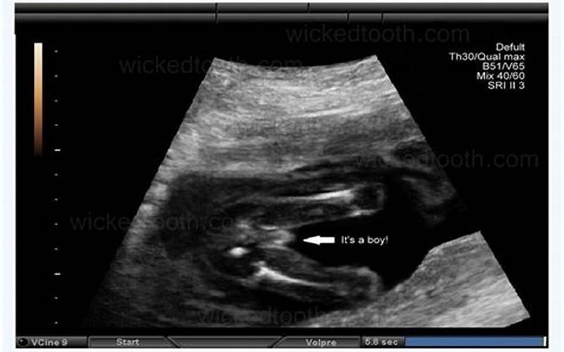 How To Identify Fake Ultrasound