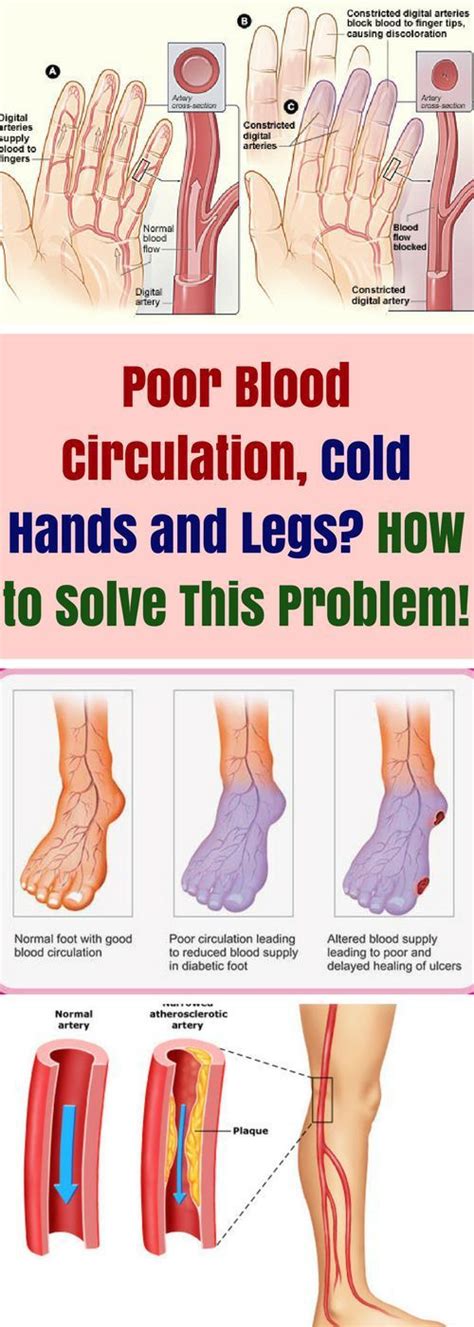 How to increase chi circulation to heal cold hands