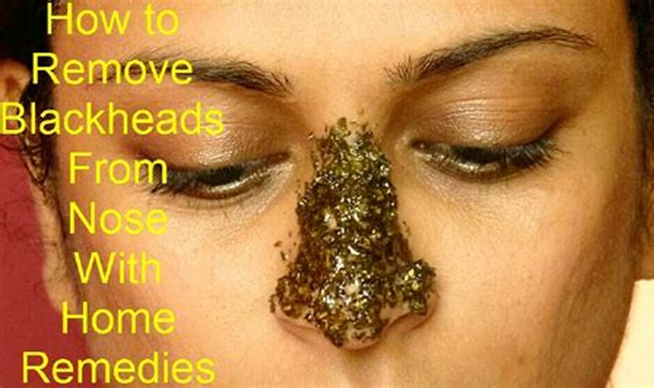 How To Remove Blackheads At Home Suyash Fashion